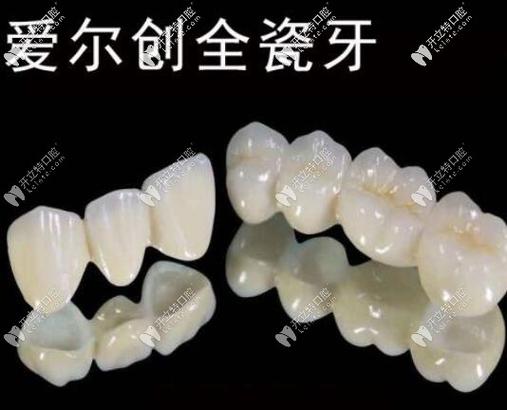 上海深圳全瓷牙怎么选?这三家口碑好的牙科别错过