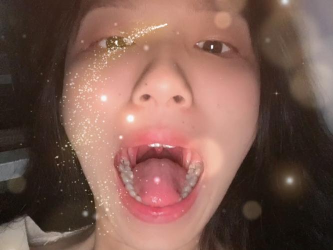 上海口腔检查第一视角真的有用吗?