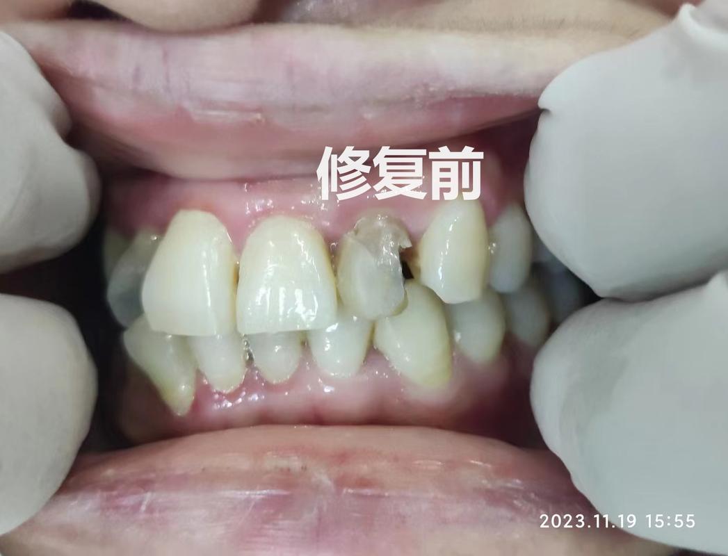 上海口腔诊疗服务怎么挑不踩坑?看牙前你最好先把这几条搞明白