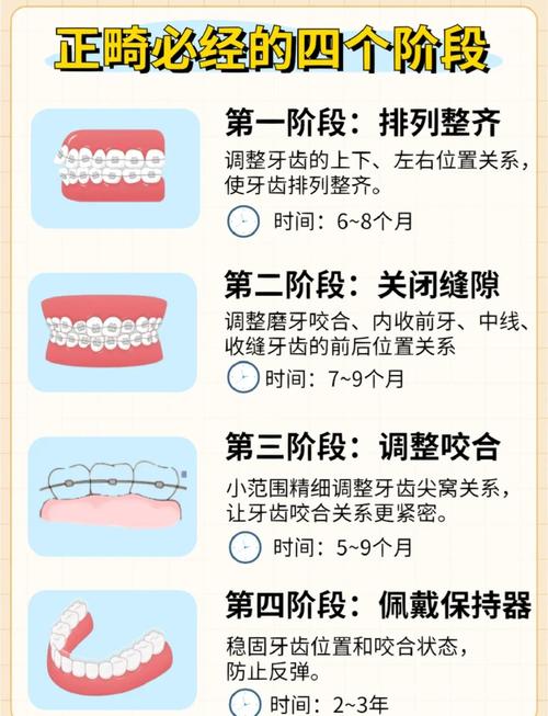上海26岁牙齿矫正要几年?过来人告诉你1.5-3年就够了