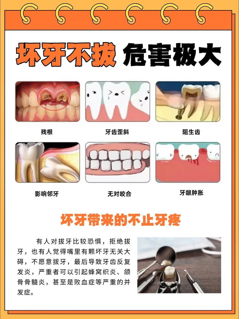 上海大牙拔掉后不种植 小心这些后果