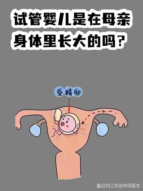 上海试管婴儿常见误区有哪些 专家一次说清