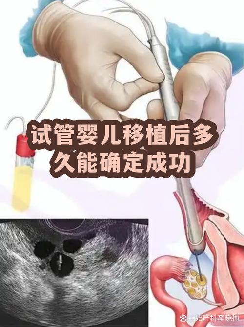 上海一代试管婴儿能成功吗 看完心里有底