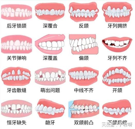 上海儿童牙齿矫正一般价格多少?带娃整牙到底花几万