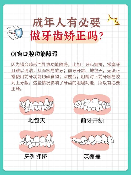 上海35岁还能不能做牙齿矫正?成人正畸风险大吗