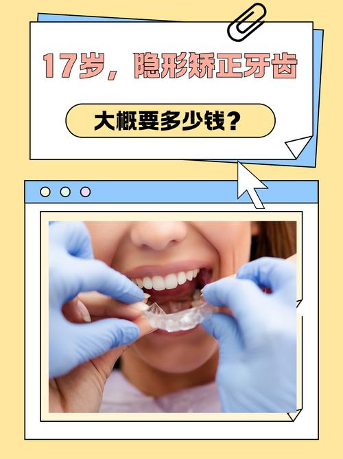 上海德韩隐形矫正牙齿效果好吗 价格多少