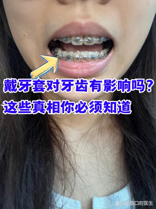 上海成人矫正牙齿口腔值得做吗 这些真相医生不会主动说