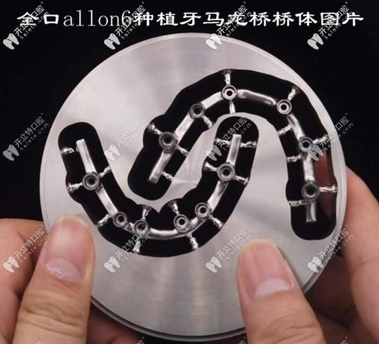 上海深圳半口All-on-4种植牙医院怎么选?地址与避坑指南