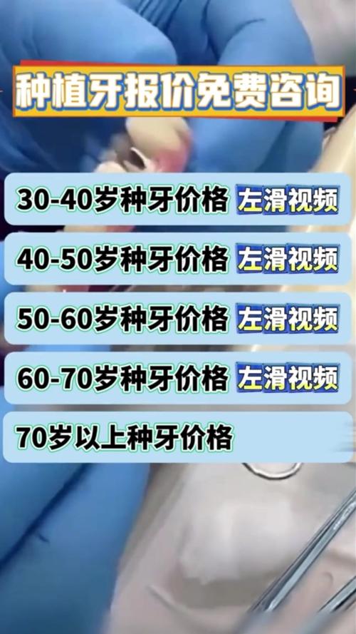 上海南充半口种牙到底要花多少钱?2026年真实报价揭秘