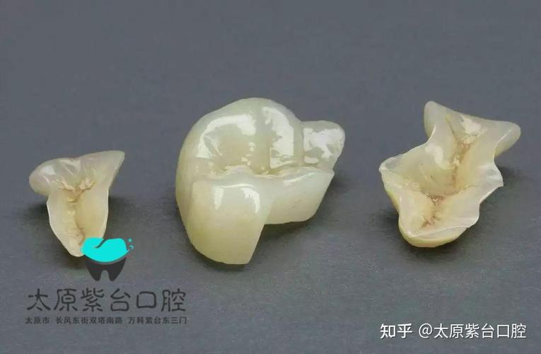 上海口腔检查反馈单看不懂?3步教你秒读