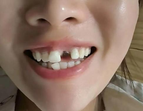 上海看牙能网上问医生吗?口腔在线解答到底靠不靠谱