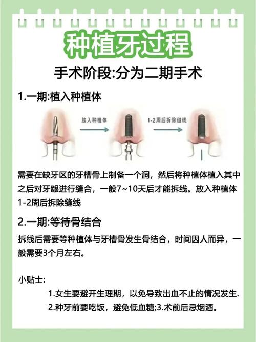 上海种牙不是埋种子等发芽 手术过程疼不疼要多久