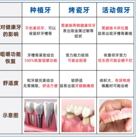上海赤峰种牙别乱选 公立三甲医院才靠谱