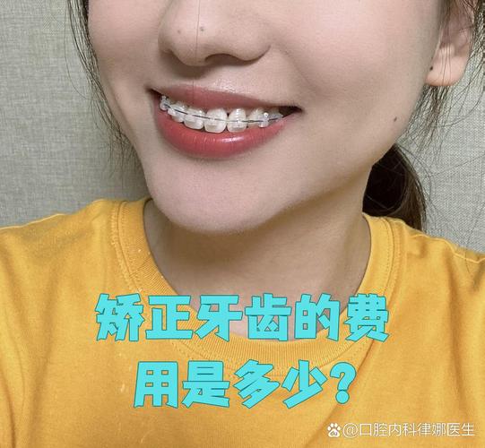 上海纠正牙型费用全解析：矫正牙齿一般要多少钱