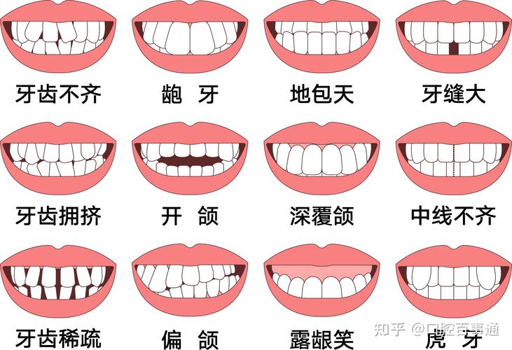 上海25岁矫正牙齿还来得及吗真实经历分享