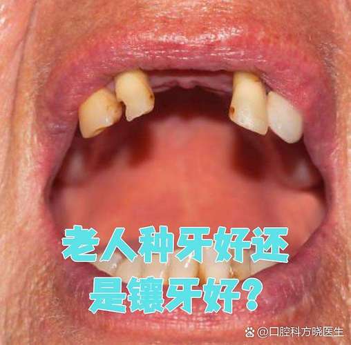 上海74岁老人种牙晚不晚？医生揭秘高龄种植的真实风险与收益