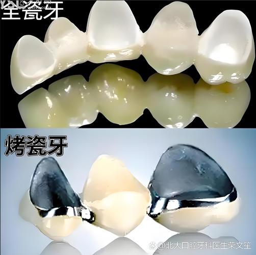 上海现在种一颗牙到底要花多少钱