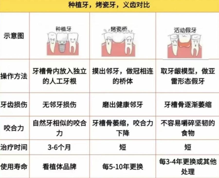 上海2万块种牙到底够不够 真实费用全解析