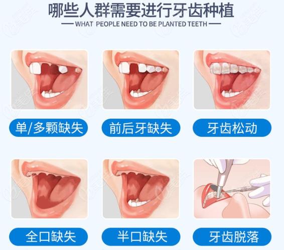 保定口腔收费医院有哪些_保定口腔收费医院电话_保定保定口腔医院收费