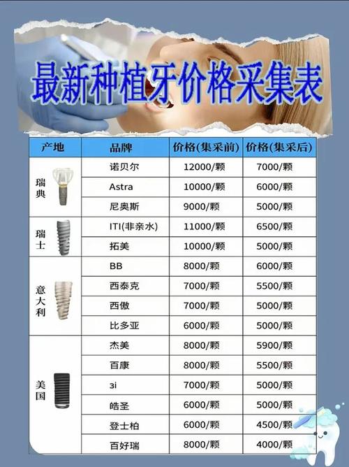 上海半口种植牙多少钱?3万起还是10万起?看品牌和骨量