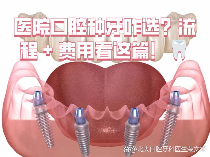 上海深圳连锁牙科种牙贵不贵?值不值得选?