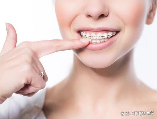 上海丹东牙齿矫正贵吗?本地人告诉你真实费用