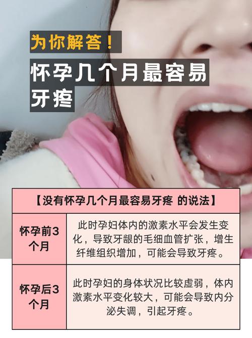 上海经期孕期感冒期,期间可以种牙吗?看身体状态定