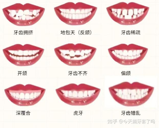 30岁牙齿矫正的利与弊_牙齿矫正弊利有哪些_牙齿矫正利大于弊吗