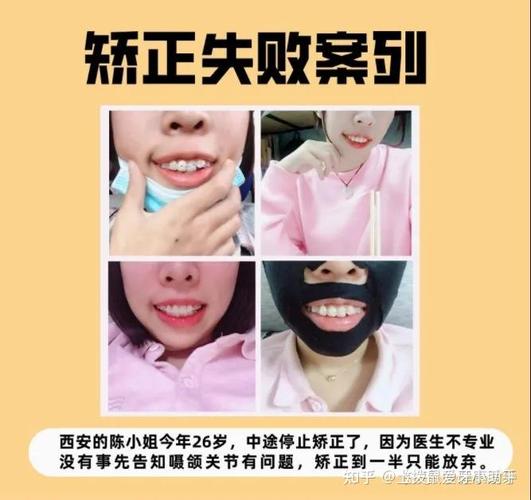 上海临沧牙齿矫正医院排名:这三家才是真靠谱