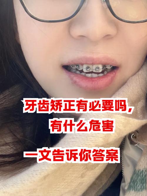 上海13岁牙齿矫正有后遗症吗?会松动、牙套脸?家长必看