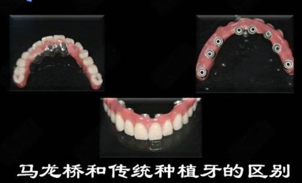 上海大同种牙哪里好 选公立还是私立更靠谱