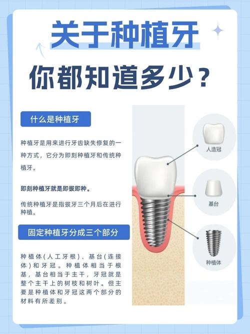 上海4颗牙一起种到底靠不靠谱 种植医生一次性讲清楚