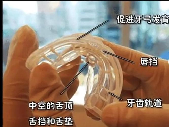 上海深圳南山儿童隐形MRC矫正费用到底多少钱?