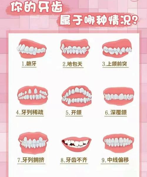 上海孩子几岁矫正牙齿最好 成人还能矫正吗
