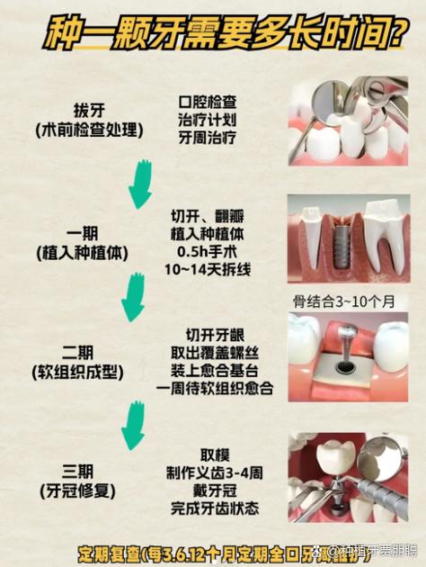 上海种牙前做CT是必须的吗 2026种牙CT检查费用全解析