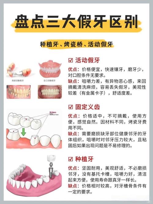 上海牙齿掉了是种牙还是镶牙 种牙过程和价格一文说清