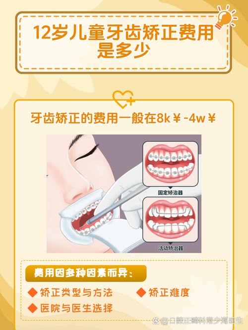 上海12岁矫正牙齿要多少钱?医生揭秘各阶段费用明细