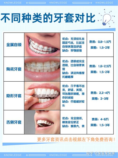 上海一颗牙矫正要花多少钱?别再被“一口价”忽悠了,费用明细全在这