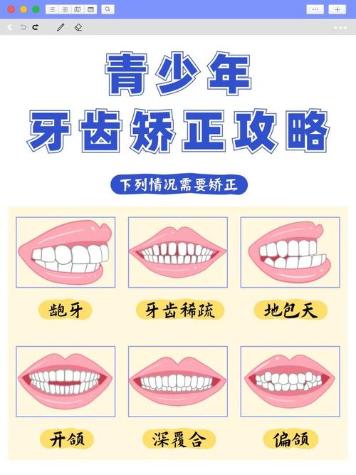 上海15岁牙齿不齐别慌!抓住矫正黄金期,这些方法快收藏