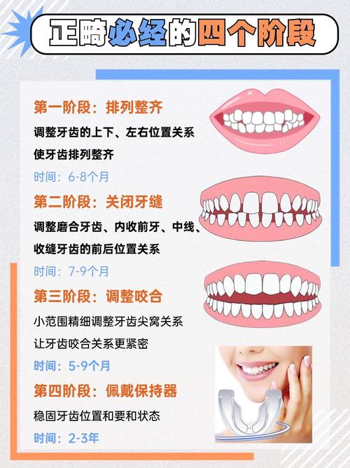 比较整齐的牙齿矫正会便宜点吗_15岁牙齿不齐如何纠正_牙齿矫正对齐
