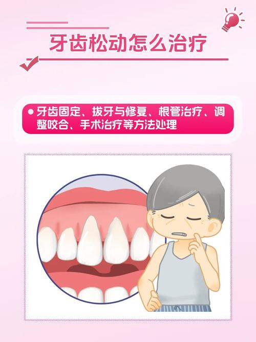 上海牙齿松动能即拔即种吗 医生说出3个关键条件
