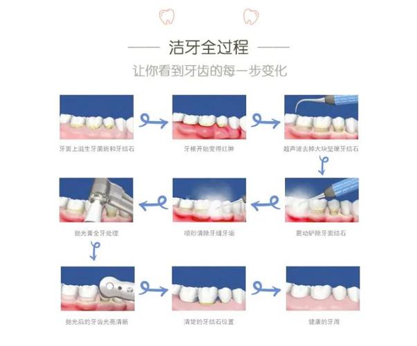 上海深圳宝安隐适美正品认证医院怎么选？