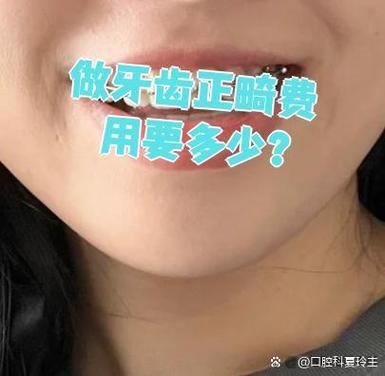 矫正牙齿的钢丝贵吗_牙齿矫正钢丝价格_深圳龙华牙齿不齐钢丝矫正费用