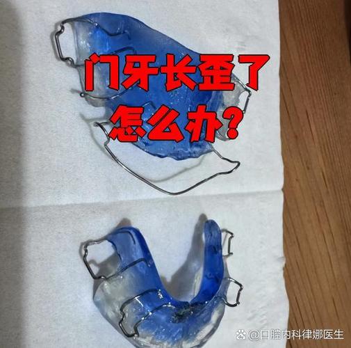 上海牙齿长歪了怎么矫正?多少钱能搞定?