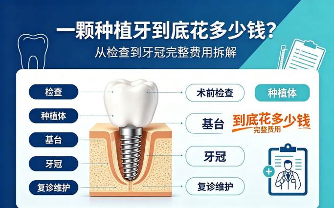 上海去口腔医院种一颗牙得花多少钱?详细拆解告诉你