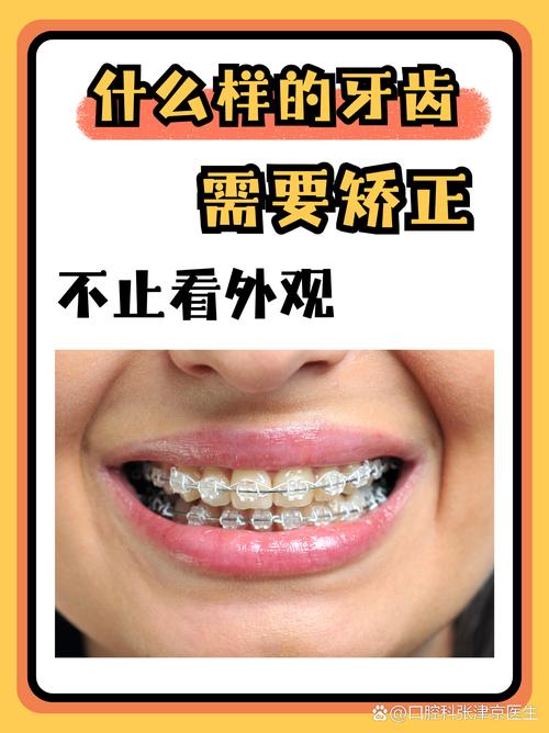矫正牙齿的晚年龄_牙齿矫正晚年后遗症_21岁矫正牙齿晚不晚