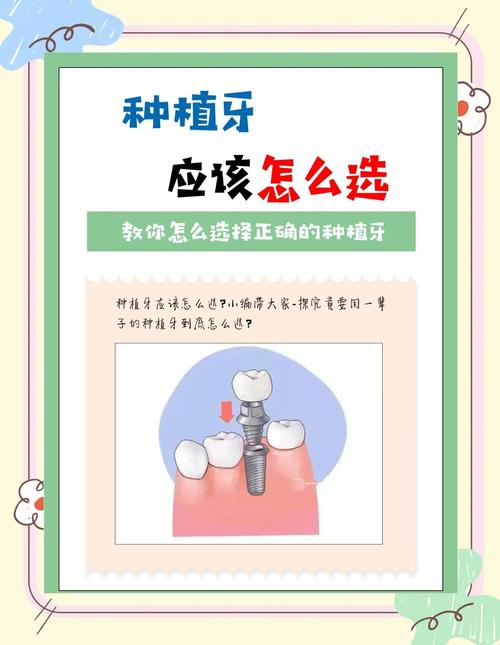 上海附近牙科种牙怎么选？这份避坑指南请收好