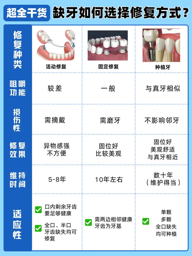 上海补牙种牙镶牙怎么选？牙医一次说清楚