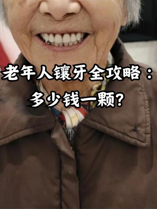 上海70岁老人牙齿缺失很苦恼，到底有没有必要种牙？看完再做决定！