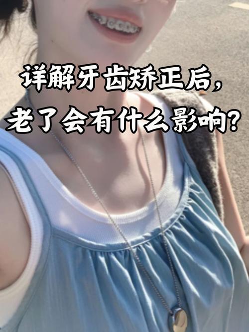 上海40岁还能矫正牙齿吗?看完这篇文章让你了解40岁牙齿矫正的真相